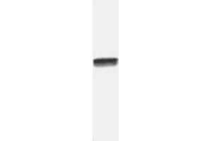 Image no. 2 for anti-Nuclear Factor-kB p65 (NFkBP65) (C-Term) antibody (ABIN221155) (NF-kB p65 antibody  (C-Term))