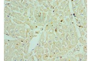 Immunohistochemistry of paraffin-embedded human heart tissue using ABIN7153379 at dilution of 1:100 (TDG antibody  (AA 141-410))