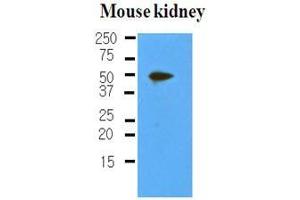 The extracts of mouse kidney (50 ug) were resolved by SDS-PAGE, transferred to nitrocellulose membrane and probed with anti-human PDPN (1:500). (Podoplanin antibody  (AA 1-206))