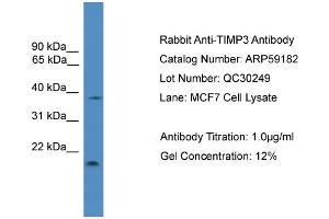 WB Suggested Anti-TIMP3  Antibody Titration: 0. (TIMP3 antibody  (Middle Region))
