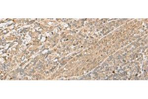 Immunohistochemistry of paraffin-embedded Human tonsil tissue using IPO11 Polyclonal Antibody at dilution of 1:70(x200) (Importin 11 antibody)