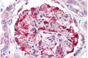 Human Kidney (formalin-fixed, paraffin-embedded) stained with CDH11 antibody ABIN337036 at 5 ug/ml followed by biotinylated goat anti-rabbit IgG secondary antibody ABIN481713, alkaline phosphatase-streptavidin and chromogen. (OB Cadherin antibody  (Intracellular))