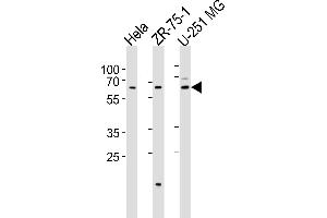 Western blot analysis of lysates from Hela, ZR-75-1, U-251 MG cell line (from left to right), using STS2 Antibody (C-term) (ABIN6244259 and ABIN6577456). (SPATS2 antibody  (C-Term))
