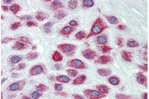 Placenta, Human: Formalin-Fixed, Paraffin-Embedded (FFPE) (LIMD1 antibody  (N-Term))