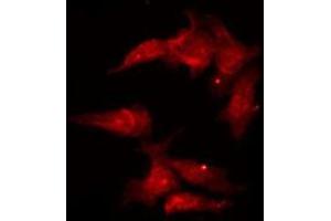 Immunofluorescence (fixed cells) (IF/ICC) image for anti-Interferon Regulatory Factor 3 (IRF3) (C-Term) antibody (ABIN6262651)