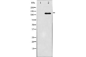 Western blot analysis of JAK2 expression in HT29 whole cell lysates,The lane on the left is treated with the antigen-specific peptide. (JAK2 antibody  (C-Term))