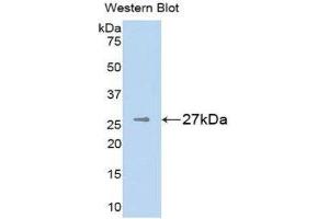 Western Blotting (WB) image for anti-Melanoma Associated Chondroitin Sulfate Proteoglycan (MCSP) (AA 1705-1942) antibody (ABIN1859793) (NG2 antibody  (AA 1705-1942))