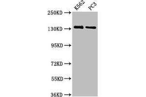 Western Blot Positive WB detected in: K562 whole cell lysate, PC-3 whole cell lysate All lanes: NRDC antibody at 3. (NRD1 antibody  (AA 32-113))