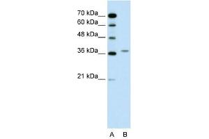 ALAD antibody used at 0. (ALAD antibody  (N-Term))