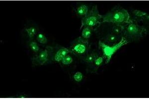 Image no. 2 for anti-Regulatory Factor X-Associated Ankyrin Containing Protein (RFXANK) antibody (ABIN1500684) (RFXANK antibody)