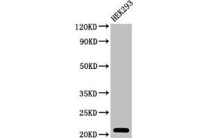 Western Blot Positive WB detected in: HEK293 whole cell lysate All lanes: TSR2 antibody at 2 μg/mL Secondary Goat polyclonal to rabbit IgG at 1/50000 dilution Predicted band size: 21 kDa Observed band size: 21 kDa (TSR2 antibody  (AA 1-191))