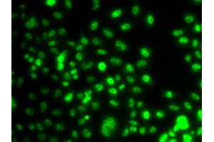 Immunofluorescence analysis of A549 cell using PAX6 antibody. (PAX6 antibody)
