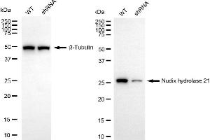 Western blotting analysis using nudix hydrolase 21 antibody (ABIN7799688).