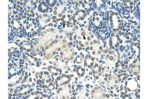 ZMYND11 antibody was used for immunohistochemistry at a concentration of 4-8 ug/ml to stain Epithelial cells of renal tubule (arrows) in Human Kidney. (ZMYND11 antibody  (N-Term))