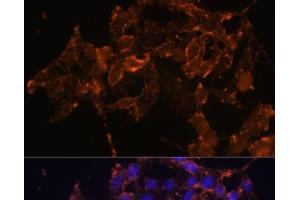 Immunofluorescence analysis of HeLa cells using PTGS1 Polyclonal Antibody at dilution of 1:100 (40x lens). (PTGS1 antibody)