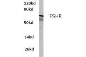 Image no. 1 for anti-Follicle Stimulating Hormone Receptor (FSHR) antibody (ABIN317650) (FSHR antibody)