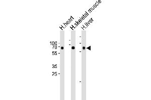 Western blot analysis of lysates from human heart, skeletal muscle and liver tissue lysate (from left to right), using Cry2 Antibody(R579) at 1:1000 at each lane. (CRY2 antibody  (C-Term))