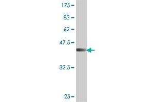 Western Blot detection against Immunogen (45. (UBE2C antibody  (AA 1-179))