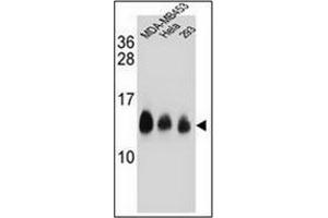 Western blot analysis of NDUFC2 Antibody (C-term) in MDA-MB453,Hela,293 cell line lysates (35ug/lane). (NDUFC2 antibody  (C-Term))