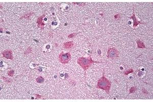 Anti-PARD3 antibody IHC staining of human brain, cortex neurons. (PARD3 antibody  (AA 1141-1190))