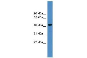 Western Blot showing SERPINB13 antibody used at a concentration of 1-2 ug/ml to detect its target protein. (SERPINB13 antibody  (Middle Region))
