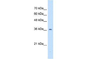 NUDT9 antibody used at 1 ug/ml to detect target protein.