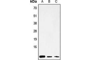 Western blot analysis of ATP8 expression in HepG2 (A), mouse brain (B), rat stomach (C) whole cell lysates. (Mitochondrially Encoded ATP Synthase 8 (MT-ATP8) (Center) antibody)