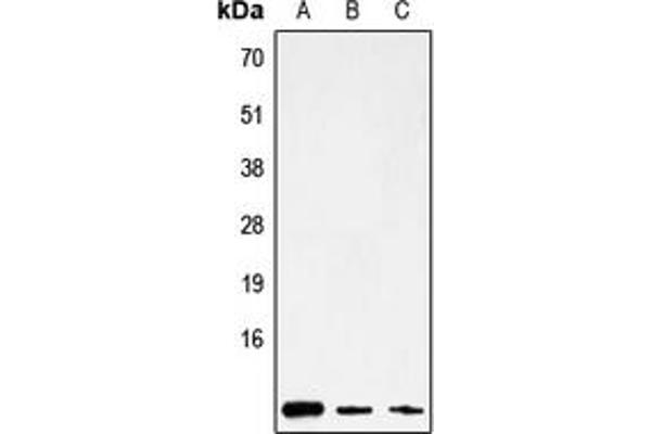 Mitochondrially Encoded ATP Synthase 8 (MT-ATP8) (Center) antibody