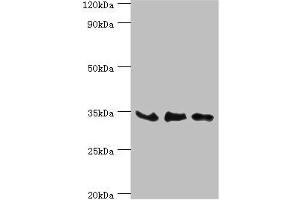 Western blot All lanes: SRM antibody at 8 μg/mL Lane 1: PC-3 whole cell lysate Lane 2: Hela whole cell lysate Lane 3: HepG2 whole cell lysate Secondary Goat polyclonal to rabbit IgG at 1/10000 dilution Predicted band size: 34 kDa Observed band size: 34 kDa (Spermidine Synthase antibody  (AA 1-302))