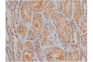 ABIN6267334 at 1/200 staining Human kidney tissue sections by IHC-P. (SP1 antibody  (pThr739))