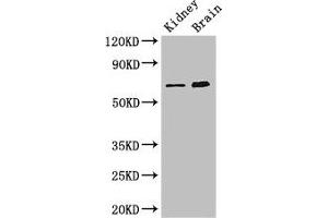 Western Blot Positive WB detected in: Mouse kidney tissue, Mouse brain tissue All lanes: ME3 antibody at 3 μg/mL Secondary Goat polyclonal to rabbit IgG at 1/50000 dilution Predicted band size: 68, 39 kDa Observed band size: 68 kDa (ME3 antibody  (AA 547-598))