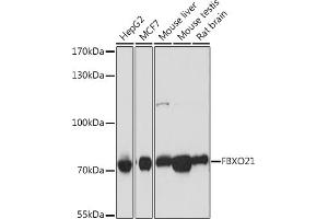 Western blot analysis of extracts of various cell lines, using FBXO21 antibody (ABIN7267085) at 1:1000 dilution. (FBXO21 antibody  (AA 440-621))
