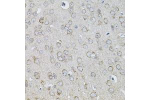 Immunohistochemistry (IHC) image for anti-Interleukin 13 (IL13) (AA 25-146) antibody (ABIN3022882)