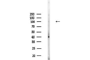 anti-RAS Guanyl Releasing Protein 3 (Calcium and DAG-Regulated) (RASGRP3) (Internal Region) antibody