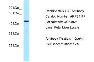 Western Blotting (WB) image for anti-Myotilin (MYOT) (C-Term) antibody (ABIN2789737) (Myotilin antibody  (C-Term))