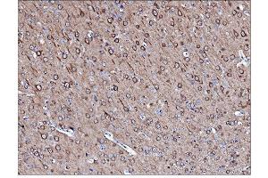 IHC analysis of PGP9. (UCHL1 antibody  (C-Term))