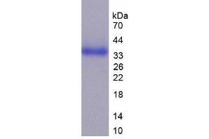 SDS-PAGE analysis of Human CD24 Protein. (CD24 Protein)