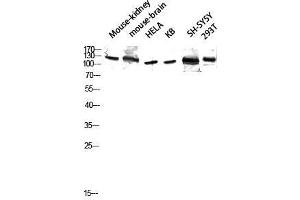 Western Blot (WB) analysis of Mouse Kidney Mouse Brain HeLa KB SH-SY5Y 293T lysis using GCP5 antibody. (TUBGCP5 antibody  (Internal Region))