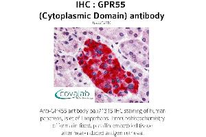 Image no. 1 for anti-G Protein-Coupled Receptor 55 (GPR55) (3rd Cytoplasmic Domain) antibody (ABIN1735122) (GPR55 antibody  (3rd Cytoplasmic Domain))
