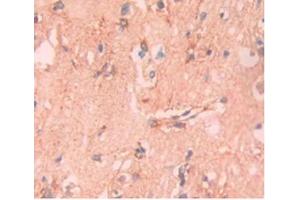DAB staining on IHC-P;Samples:Human Brain Tissue.