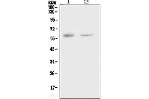 Western blot analysis of CSF1 using anti-CSF1 antibody (ABIN6719490).