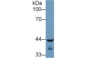 Detection of REV1 in Human A549 cell lysate using Polyclonal Antibody to REV1 Homolog (REV1) (REV1 antibody  (AA 301-478))