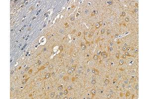 ABIN6260909 and ABIN6279332 at 1/100 staining rat brain tissue by IHC-P.