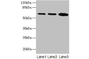 Western blot All lanes: SPTLC2 antibody at 12 μg/mL Lane 1: HepG2 whole cell lysate Lane 2: A549 whole cell lysate Lane 3: HT29 whole cell lysate Secondary Goat polyclonal to rabbit IgG at 1/10000 dilution Predicted band size: 63 kDa Observed band size: 63 kDa (SPTLC2 antibody  (AA 88-562))