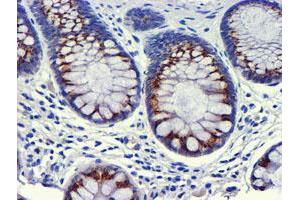 Immunohistochemical staining of paraffin-embedded Human colon tissue using anti-GOLM1 mouse monoclonal antibody.