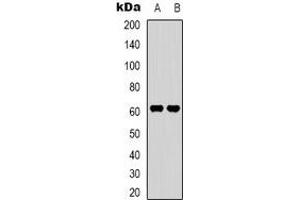 Western blot analysis of SVOP expression in HepG2 (A), K562 (B) whole cell lysates. (SVOP antibody)