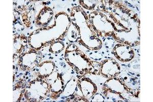 Immunohistochemical staining of paraffin-embedded Kidney tissue using anti-PSMC3mouse monoclonal antibody. (PSMC3 antibody)