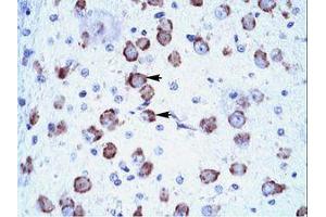 Image no. 1 for anti-Mediator Complex Subunit 17 (MED17) (AA 156-205) antibody (ABIN6735876) (MED17 antibody  (AA 156-205))