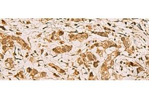 anti-Zinc Finger, Matrin-Type 4 (ZMAT4) antibody