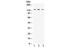 Western blot testing of 1) rat thymus, 2) mouse thymus and 3) MCF7 lysate with CIITA antibody at 0.